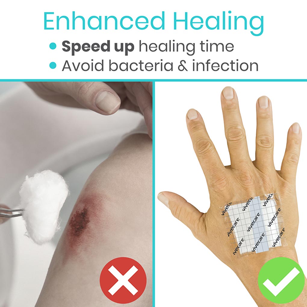 Vive -ViveCare - Bandages - Transparent Adhesive Bandage - 2", 4", 6", or 8" - HCPCS: A4452