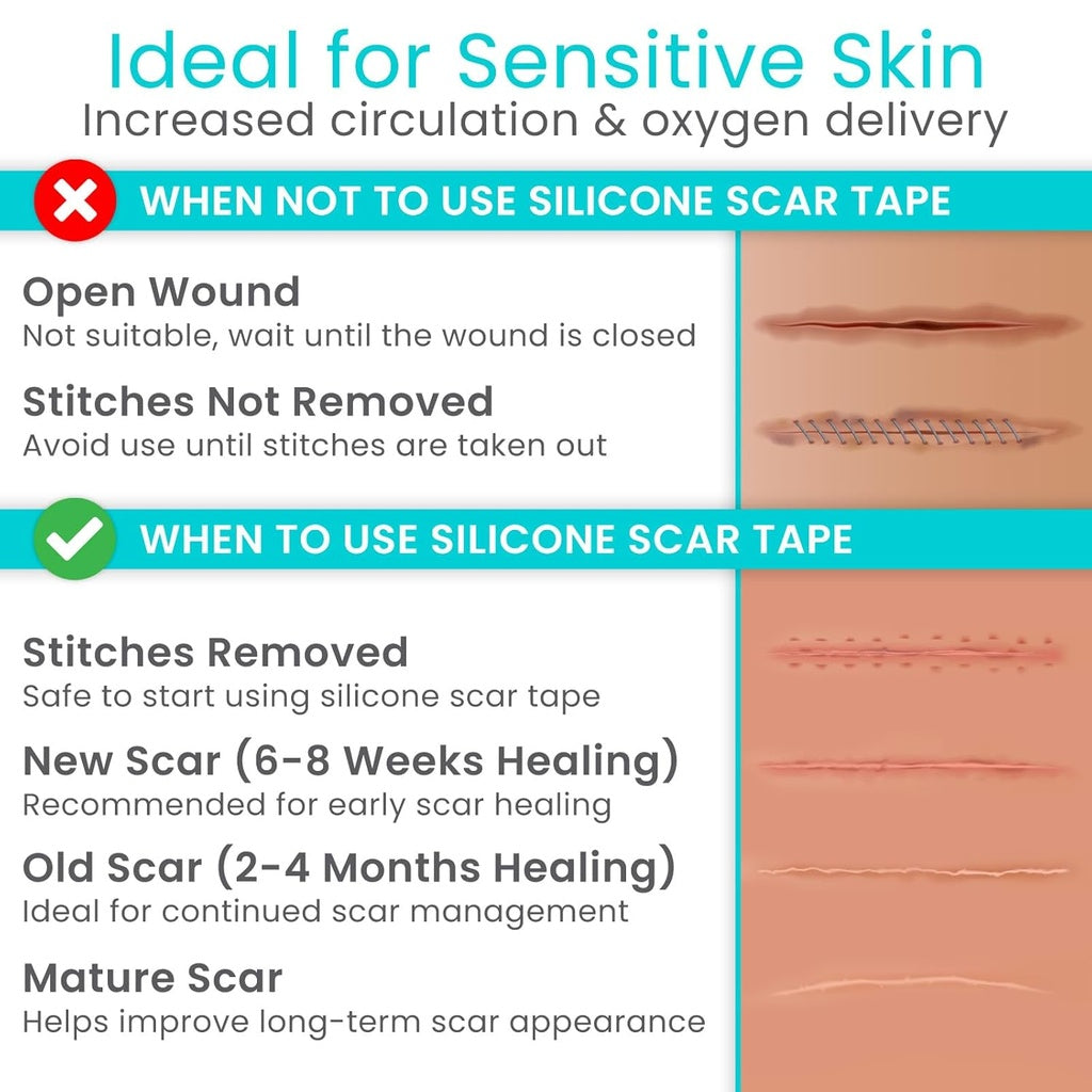 Vive - ViveCare - Tapes & Closure - Silicone Scar Tape