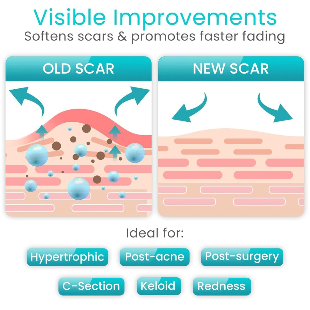 Vive - ViveCare - Tapes & Closure - Silicone Scar Tape